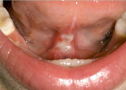 吃小瓜舌根发麻,揭秘小瓜为何引发舌根麻麻之感